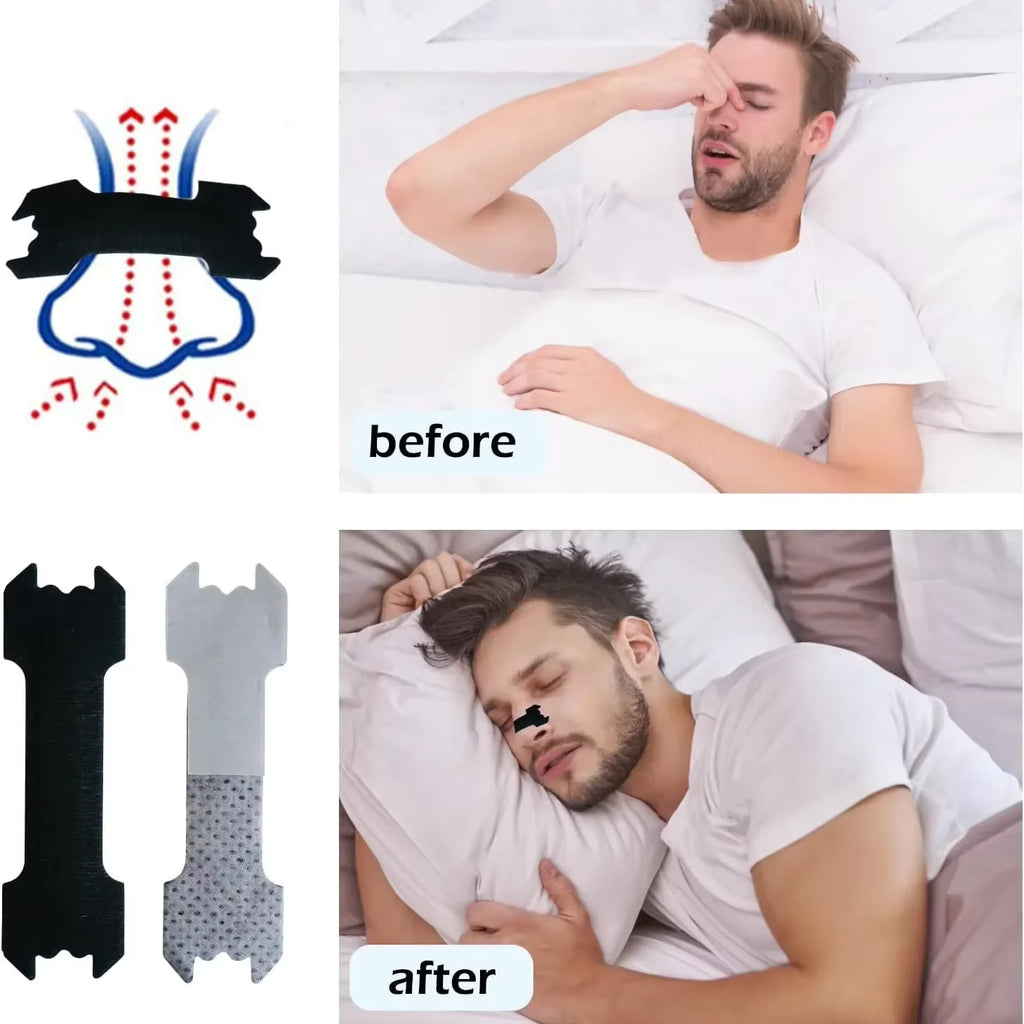 30 PCS Anti-Snoring Nasal Strips – Enhanced Adhesion, Comfortable & Breathable, Better Airflow for Sleep & Sports, Non-Invasive Nasal Dilator