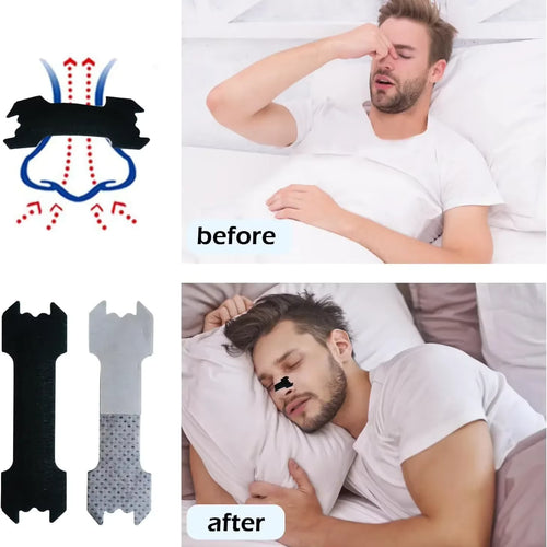 30 PCS Anti-Snoring Nasal Strips – Enhanced Adhesion, Comfortable & Breathable, Better Airflow for Sleep & Sports, Non-Invasive Nasal Dilator